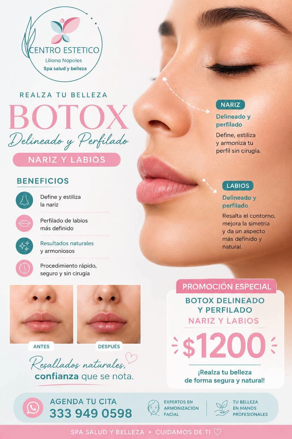Botox delineado y perfilado de nariz y labios