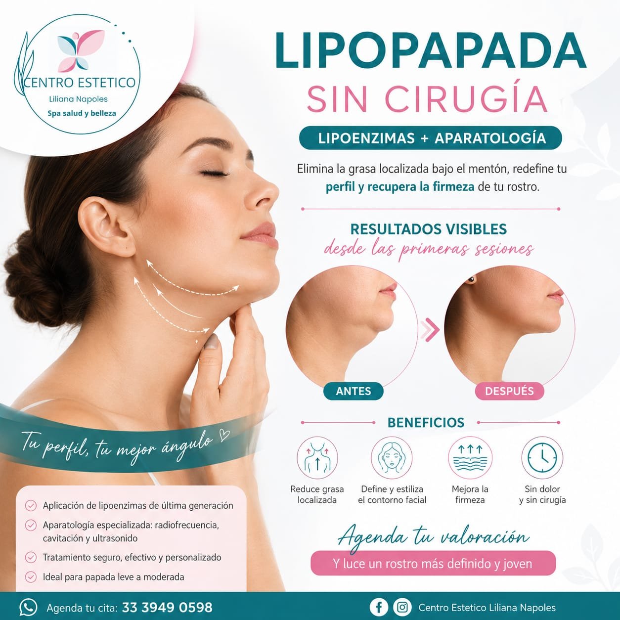 Lipopapada sin cirugía con lipoenzimas y aparatología