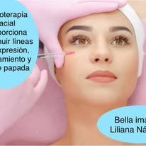Mesoterapia facial para disminuir líneas de expresión y papada