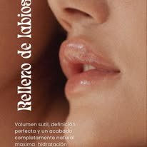 Tratamiento de relleno de labios con ácido hialurónico para volumen natural e hidratación
