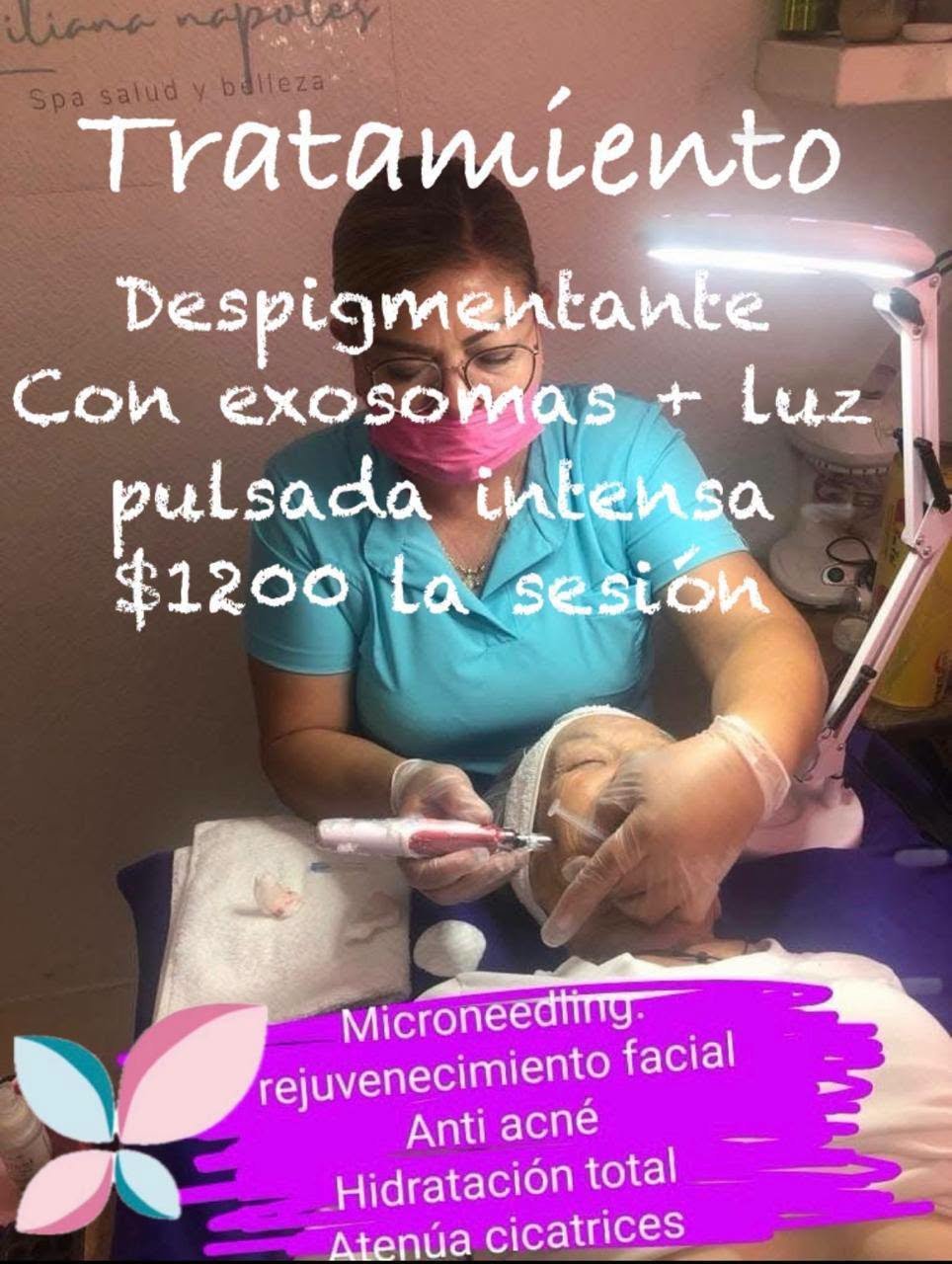 Tratamiento despigmentante avanzado con exosomas y luz pulsada intensa (IPL) en Tonalá