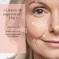 Publicación promocional de aplicación de Bótox estético