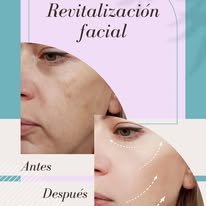 Promoción especial de fin de semana en tratamientos estéticos